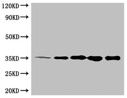6*His 單克隆抗體 (CSB-MA000011M0m)