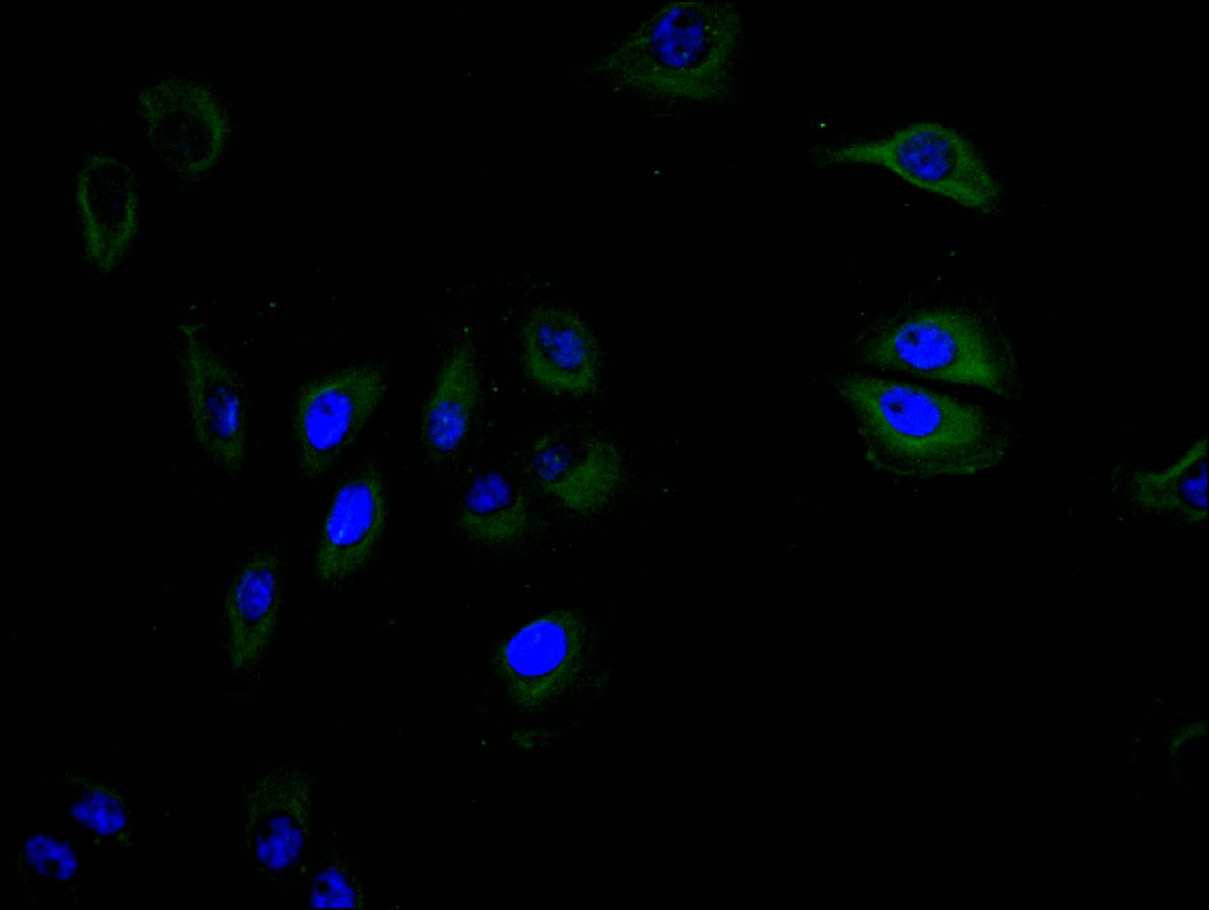 CSB-RA004936MA1HU IF