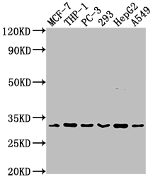 CSB-RA934881A0HU