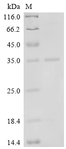 CSB-EP025833HU