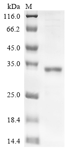 CSB-EP623788HU